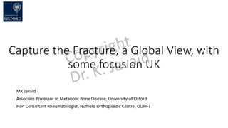 Capture the Fracture, a Global View, with
some focus on UK
MK Javaid
Associate Professor in Metabolic Bone Disease, University of Oxford
Hon Consultant Rheumatologist, Nuffield Orthopaedic Centre, OUHFT
 