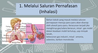 1. Melalui Saluran Pernafasan
(Inhalasi)
Bahan toksik yang masuk melalui saluran
pernapasan menuju paru-paru akan diserap
oleh alveoli paru-paru. Keracunan terjadi jika
menghirup gas/udara beracun, misal : gas mobil
dalam keadaan mobil tertutup, uap minyak
tanah,
kebocoran gas industri, misal : amonia,
asbestos, karbon monoksida.
 