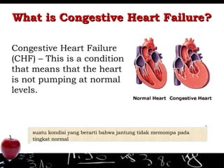 What is Congestive Heart Failure?What is Congestive Heart Failure?
Congestive Heart Failure
(CHF) – This is a condition
that means that the heart
is not pumping at normal
levels.
suatu kondisi yang berarti bahwa jantung tidak memompa pada
tingkat normal
 