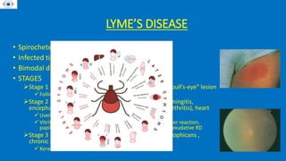 INTERMEDIATE_UVEITIS presentation dhir hospital bhiwani.pptx