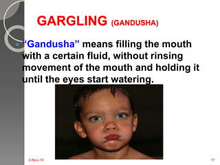 GARGLING (GANDUSHA) 
 “Gandusha” means filling the mouth 
with a certain fluid, without rinsing 
movement of the mouth and holding it 
until the eyes start watering. 
2-Nov-14 17 
 