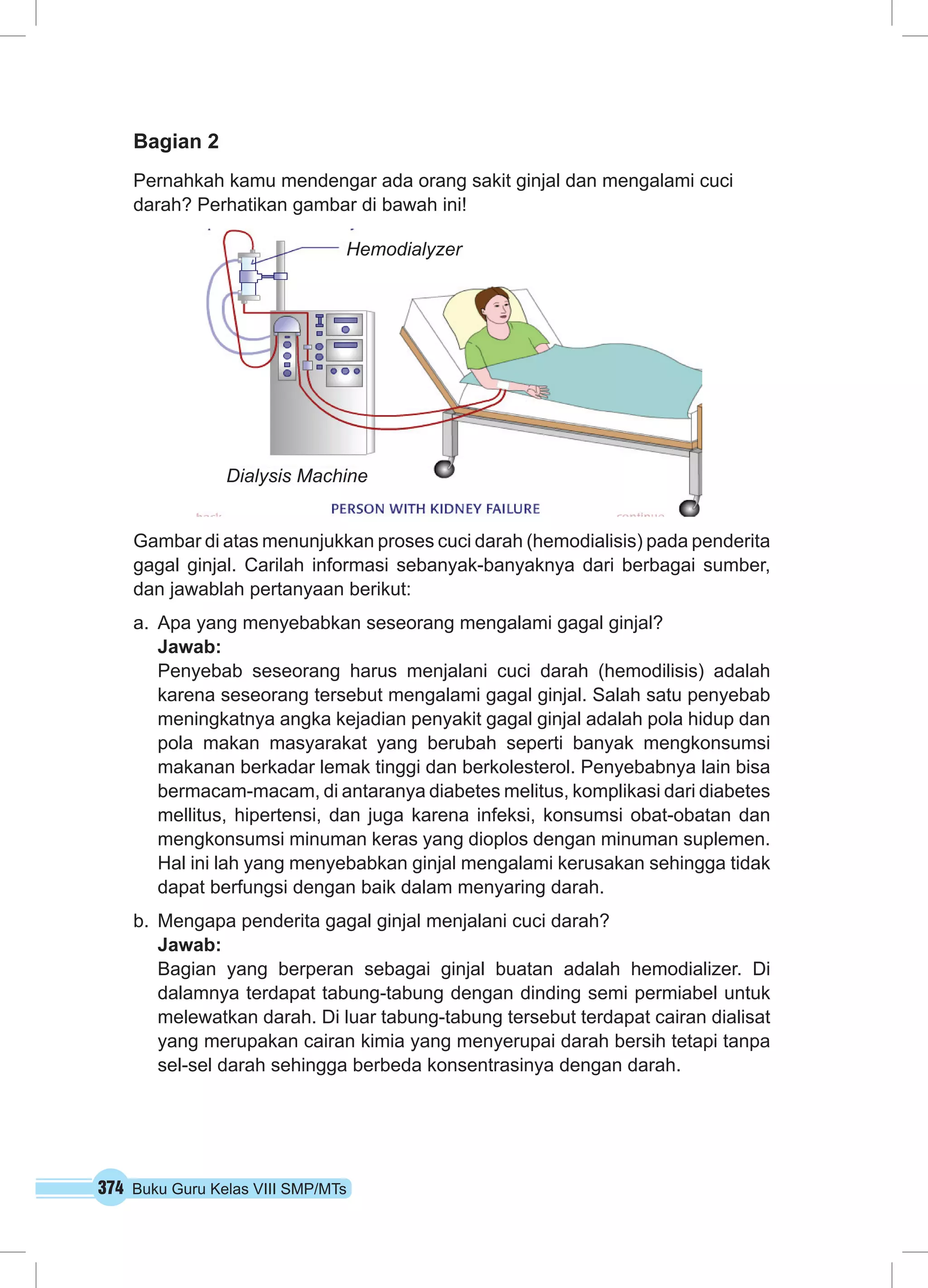 374 Buku Guru Kelas VIII SMP/MTs
Bagian 2
Pernahkah kamu mendengar ada orang sakit ginjal dan mengalami cuci
darah? Perhatikan gambar di bawah ini!
Gambar di atas menunjukkan proses cuci darah (hemodialisis) pada penderita
gagal ginjal. Carilah informasi sebanyak-banyaknya dari berbagai sumber,
dan jawablah pertanyaan berikut:
a.	 Apa yang menyebabkan seseorang mengalami gagal ginjal?
Jawab:
Penyebab seseorang harus menjalani cuci darah (hemodilisis) adalah
karena seseorang tersebut mengalami gagal ginjal. Salah satu penyebab
meningkatnya angka kejadian penyakit gagal ginjal adalah pola hidup dan
pola makan masyarakat yang berubah seperti banyak mengkonsumsi
makanan berkadar lemak tinggi dan berkolesterol. Penyebabnya lain bisa
bermacam-macam, di antaranya diabetes melitus, komplikasi dari diabetes
mellitus, hipertensi, dan juga karena infeksi, konsumsi obat-obatan dan
mengkonsumsi minuman keras yang dioplos dengan minuman suplemen.
Hal ini lah yang menyebabkan ginjal mengalami kerusakan sehingga tidak
dapat berfungsi dengan baik dalam menyaring darah.
b.	 Mengapa penderita gagal ginjal menjalani cuci darah?
Jawab:
Bagian yang berperan sebagai ginjal buatan adalah hemodializer. Di
dalamnya terdapat tabung-tabung dengan dinding semi permiabel untuk
melewatkan darah. Di luar tabung-tabung tersebut terdapat cairan dialisat
yang merupakan cairan kimia yang menyerupai darah bersih tetapi tanpa
sel-sel darah sehingga berbeda konsentrasinya dengan darah.
Hemodialyzer
Dialysis Machine
 