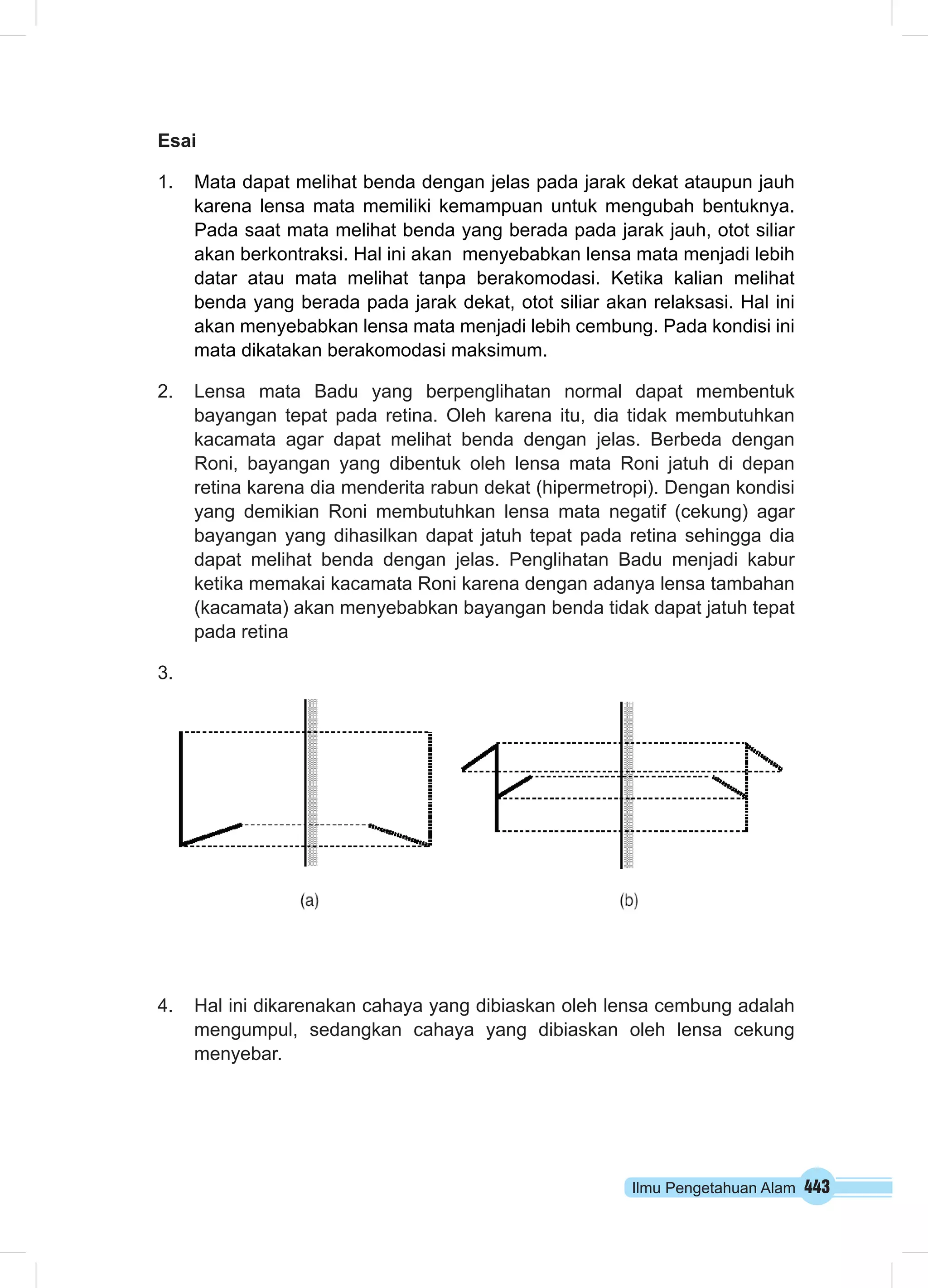 Ilmu Pengetahuan Alam 443
Esai
1.	 Mata dapat melihat benda dengan jelas pada jarak dekat ataupun jauh
karena lensa mata memiliki kemampuan untuk mengubah bentuknya.
Pada saat mata melihat benda yang berada pada jarak jauh, otot siliar
akan berkontraksi. Hal ini akan menyebabkan lensa mata menjadi lebih
datar atau mata melihat tanpa berakomodasi. Ketika kalian melihat
benda yang berada pada jarak dekat, otot siliar akan relaksasi. Hal ini
akan menyebabkan lensa mata menjadi lebih cembung. Pada kondisi ini
mata dikatakan berakomodasi maksimum.
2.	 Lensa mata Badu yang berpenglihatan normal dapat membentuk
bayangan tepat pada retina. Oleh karena itu, dia tidak membutuhkan
kacamata agar dapat melihat benda dengan jelas. Berbeda dengan
Roni, bayangan yang dibentuk oleh lensa mata Roni jatuh di depan
retina karena dia menderita rabun dekat (hipermetropi). Dengan kondisi
yang demikian Roni membutuhkan lensa mata negatif (cekung) agar
bayangan yang dihasilkan dapat jatuh tepat pada retina sehingga dia
dapat melihat benda dengan jelas. Penglihatan Badu menjadi kabur
ketika memakai kacamata Roni karena dengan adanya lensa tambahan
(kacamata) akan menyebabkan bayangan benda tidak dapat jatuh tepat
pada retina
3.	
4.	 Hal ini dikarenakan cahaya yang dibiaskan oleh lensa cembung adalah
mengumpul, sedangkan cahaya yang dibiaskan oleh lensa cekung
menyebar.
 