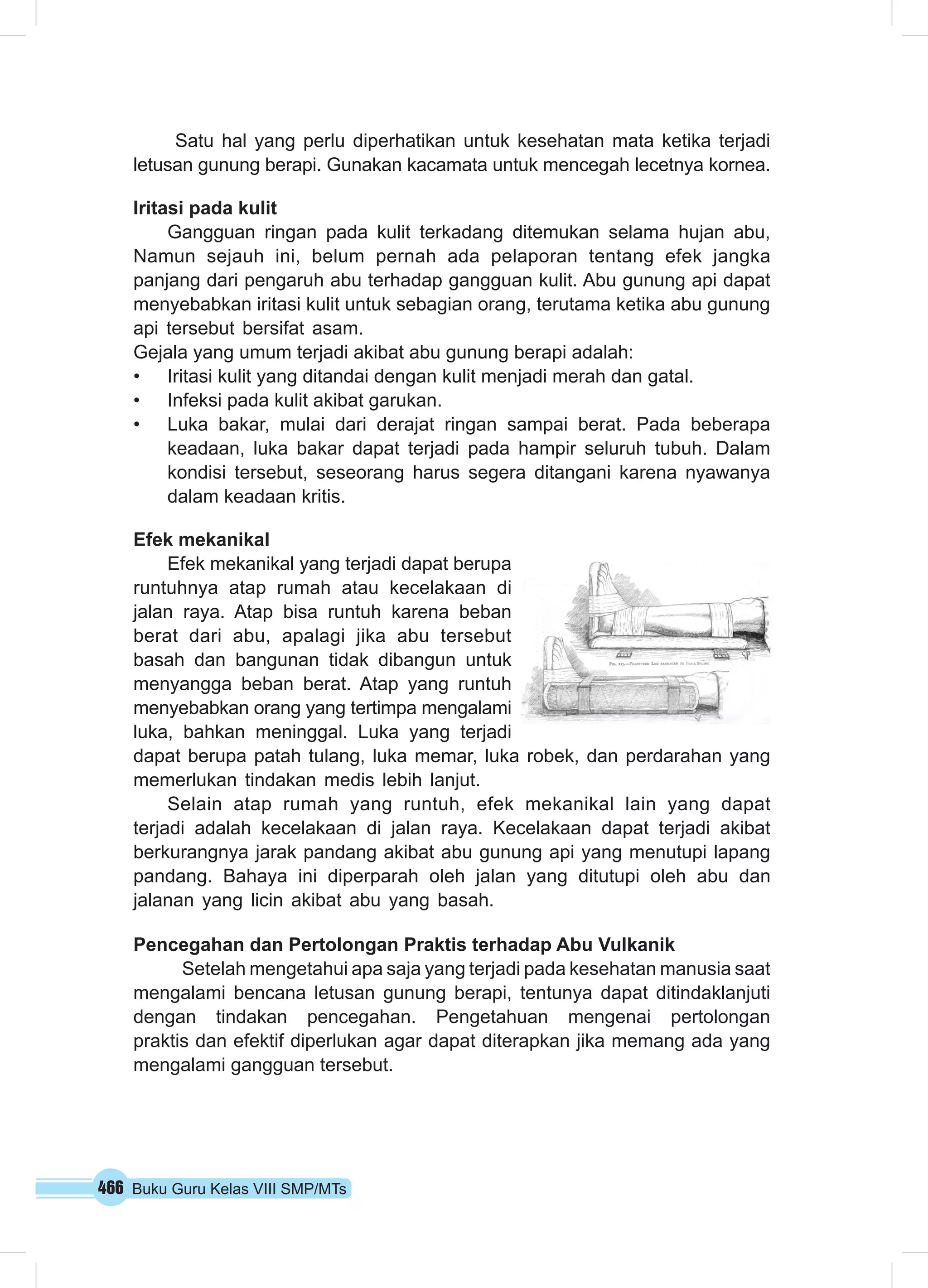 466 Buku Guru Kelas VIII SMP/MTs
Satu hal yang perlu diperhatikan untuk kesehatan mata ketika terjadi
letusan gunung berapi. Gunakan kacamata untuk mencegah lecetnya kornea.
Iritasi pada kulit
Gangguan ringan pada kulit terkadang ditemukan selama hujan abu,
Namun sejauh ini, belum pernah ada pelaporan tentang efek jangka
panjang dari pengaruh abu terhadap gangguan kulit. Abu gunung api dapat
menyebabkan iritasi kulit untuk sebagian orang, terutama ketika abu gunung
api tersebut bersifat asam.
Gejala yang umum terjadi akibat abu gunung berapi adalah:
•	 Iritasi kulit yang ditandai dengan kulit menjadi merah dan gatal.
•	 Infeksi pada kulit akibat garukan.
•	 Luka bakar, mulai dari derajat ringan sampai berat. Pada beberapa
keadaan, luka bakar dapat terjadi pada hampir seluruh tubuh. Dalam
kondisi tersebut, seseorang harus segera ditangani karena nyawanya
dalam keadaan kritis.
Efek mekanikal
Efek mekanikal yang terjadi dapat berupa
runtuhnya atap rumah atau kecelakaan di
jalan raya. Atap bisa runtuh karena beban
berat dari abu, apalagi jika abu tersebut
basah dan bangunan tidak dibangun untuk
menyangga beban berat. Atap yang runtuh
menyebabkan orang yang tertimpa mengalami
luka, bahkan meninggal. Luka yang terjadi
dapat berupa patah tulang, luka memar, luka robek, dan perdarahan yang
memerlukan tindakan medis lebih lanjut.
Selain atap rumah yang runtuh, efek mekanikal lain yang dapat
terjadi adalah kecelakaan di jalan raya. Kecelakaan dapat terjadi akibat
berkurangnya jarak pandang akibat abu gunung api yang menutupi lapang
pandang. Bahaya ini diperparah oleh jalan yang ditutupi oleh abu dan
jalanan yang licin akibat abu yang basah.
Pencegahan dan Pertolongan Praktis terhadap Abu Vulkanik
Setelah mengetahui apa saja yang terjadi pada kesehatan manusia saat
mengalami bencana letusan gunung berapi, tentunya dapat ditindaklanjuti
dengan tindakan pencegahan. Pengetahuan mengenai pertolongan
praktis dan efektif diperlukan agar dapat diterapkan jika memang ada yang
mengalami gangguan tersebut.
 