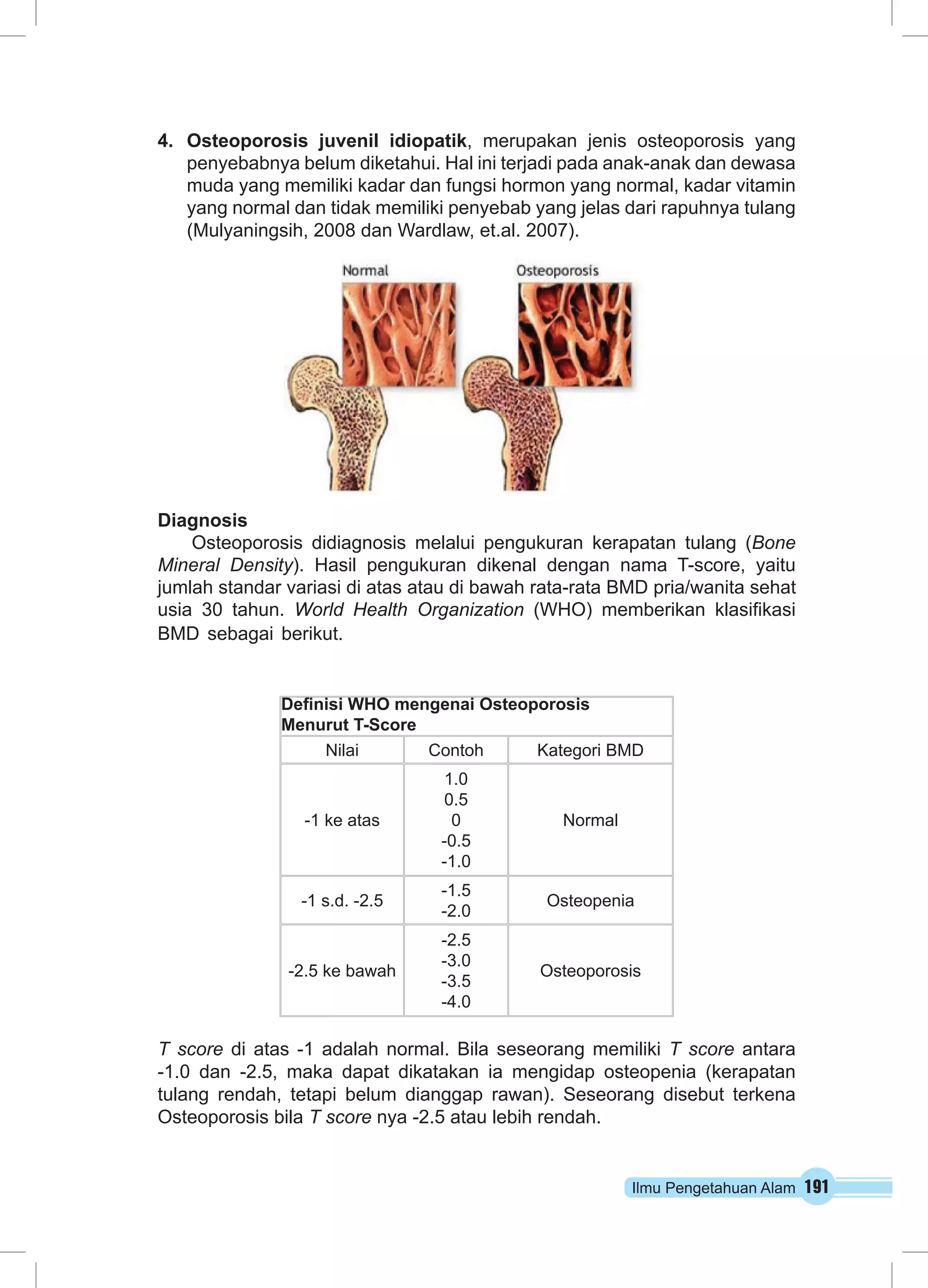 4. Osteoporosis juvenil idiopatik, merupakan jenis osteoporosis yang 
penyebabnya belum diketahui. Hal ini terjadi pada anak-anak dan dewasa 
muda yang memiliki kadar dan fungsi hormon yang normal, kadar vitamin 
yang normal dan tidak memiliki penyebab yang jelas dari rapuhnya tulang 
(Mulyaningsih, 2008 dan Wardlaw, et.al. 2007). 
Ilmu Pengetahuan Alam 191 
Diagnosis 
Osteoporosis didiagnosis melalui pengukuran kerapatan tulang (Bone 
Mineral Density). Hasil pengukuran dikenal dengan nama T-score, yaitu 
jumlah standar variasi di atas atau di bawah rata-rata BMD pria/wanita sehat 
usia 30 tahun. World Health Organization (WHO) memberikan klasifikasi 
BMD sebagai berikut. 
Definisi WHO mengenai Osteoporosis 
Menurut T-Score 
Nilai Contoh Kategori BMD 
-1 ke atas 
1.0 
0.5 
0 
-0.5 
-1.0 
Normal 
-1 s.d. -2.5 -1.5 
-2.0 Osteopenia 
-2.5 ke bawah 
-2.5 
-3.0 
-3.5 
-4.0 
Osteoporosis 
T score di atas -1 adalah normal. Bila seseorang memiliki T score antara 
-1.0 dan -2.5, maka dapat dikatakan ia mengidap osteopenia (kerapatan 
tulang rendah, tetapi belum dianggap rawan). Seseorang disebut terkena 
Osteoporosis bila T score nya -2.5 atau lebih rendah. 
 