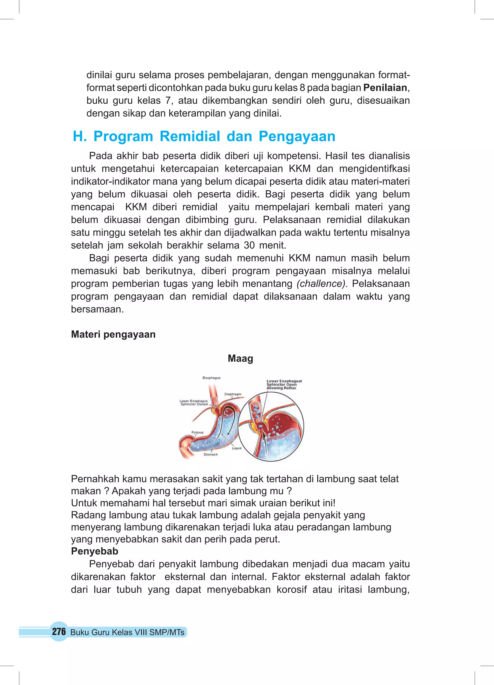 dinilai guru selama proses pembelajaran, dengan menggunakan format-format 
seperti dicontohkan pada buku guru kelas 8 pada bagian Penilaian, 
buku guru kelas 7, atau dikembangkan sendiri oleh guru, disesuaikan 
dengan sikap dan keterampilan yang dinilai. 
H. Program Remidial dan Pengayaan 
Pada akhir bab peserta didik diberi uji kompetensi. Hasil tes dianalisis 
untuk mengetahui ketercapaian ketercapaian KKM dan mengidentifkasi 
indikator-indikator mana yang belum dicapai peserta didik atau materi-materi 
yang belum dikuasai oleh peserta didik. Bagi peserta didik yang belum 
mencapai KKM diberi remidial yaitu mempelajari kembali materi yang 
belum dikuasai dengan dibimbing guru. Pelaksanaan remidial dilakukan 
satu minggu setelah tes akhir dan dijadwalkan pada waktu tertentu misalnya 
setelah jam sekolah berakhir selama 30 menit. 
Bagi peserta didik yang sudah memenuhi KKM namun masih belum 
memasuki bab berikutnya, diberi program pengayaan misalnya melalui 
program pemberian tugas yang lebih menantang (challence). Pelaksanaan 
program pengayaan dan remidial dapat dilaksanaan dalam waktu yang 
bersamaan. 
Materi pengayaan 
276 Buku Guru Kelas VIII SMP/MTs 
Maag 
Pernahkah kamu merasakan sakit yang tak tertahan di lambung saat telat 
makan ? Apakah yang terjadi pada lambung mu ? 
Untuk memahami hal tersebut mari simak uraian berikut ini! 
Radang lambung atau tukak lambung adalah gejala penyakit yang 
menyerang lambung dikarenakan terjadi luka atau peradangan lambung 
yang menyebabkan sakit dan perih pada perut. 
Penyebab 
Penyebab dari penyakit lambung dibedakan menjadi dua macam yaitu 
dikarenakan faktor eksternal dan internal. Faktor eksternal adalah faktor 
dari luar tubuh yang dapat menyebabkan korosif atau iritasi lambung, 
 