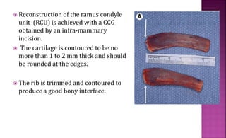  Reconstruction of the ramus condyle
unit (RCU) is achieved with a CCG
obtained by an infra-mammary
incision.
 The cartilage is contoured to be no
more than 1 to 2 mm thick and should
be rounded at the edges.
 The rib is trimmed and contoured to
produce a good bony interface.
 