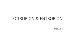 ECTROPION & ENTROPION
KABILAN. S
 