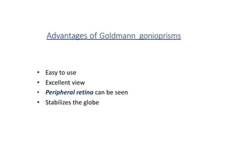 Advantages of Goldmann gonioprisms
• Easy to use
• Excellent view
• Peripheral retina can be seen
• Stabilizes the globe
 