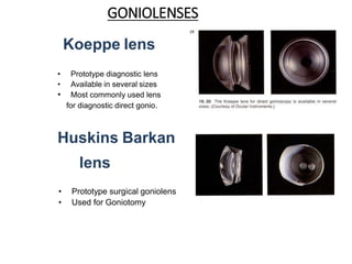 GONIOLENSES
Koeppe lens
• Prototype diagnostic lens
• Available in several sizes
• Most commonly used lens
for diagnostic direct gonio.
Huskins Barkan
lens
• Prototype surgical goniolens
• Used for Goniotomy
 