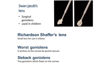 Swanjacob’s
lens
• Surgical
goniolens
• used in children
Richardson Shaffer’s lens
Small lens for use in infants
Worst goniolens
It anchors to the cornea by partial vaccum
Sieback goniolens
Tiny goniolens which floats on the cornea
 