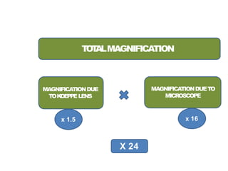T
O
T
ALMAGNIFICATION
MAGNIFICATIONDUE
TOK
OEPPELENS
MAGNIFICATIONDUETO
MICROSCOPE
x 1.5 x 16
X 24
 