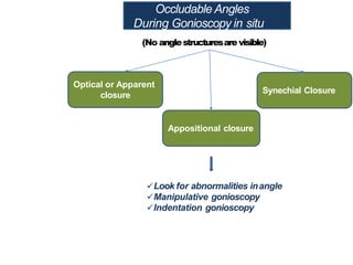 Occludable Angles
During Gonioscopy in situ
(No anglestructuresare visible)
Optical or Apparent
closure
Appositional closure
Synechial Closure
Look for abnormalities inangle
Manipulative gonioscopy
Indentation gonioscopy
 
