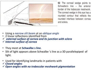 • Using a narrow slit beam at an oblique angle
• 2 linear reflections identified from
 external surface of cornea and its junction with sclera
 Internal surface of cornea
• They meet at Schwalbe s line.
• Slit of light appears above Schwalbe ‘s line as a 3D parallelepiped of
light.
• Used for identifying landmarks in patients with
 Closed angles
 Open angles with no trabecular meshwork pigmentation
 