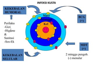INFEKSI KUSTA

KEKEBALAN
HUMORAL
Masy
Tetangga
Perilaku
-Gizi
-Higiene
&
Sanitasi
-Sos-Ek

BCG
(+)

Kel

MDT
(+)

KEKEBALAN
SELULAR

2 minggu pengob.
(-) menular

 