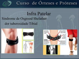 Infra Patelar
Sindrome de Osgrood Shelather
dor tuberosidade Tibial
 
