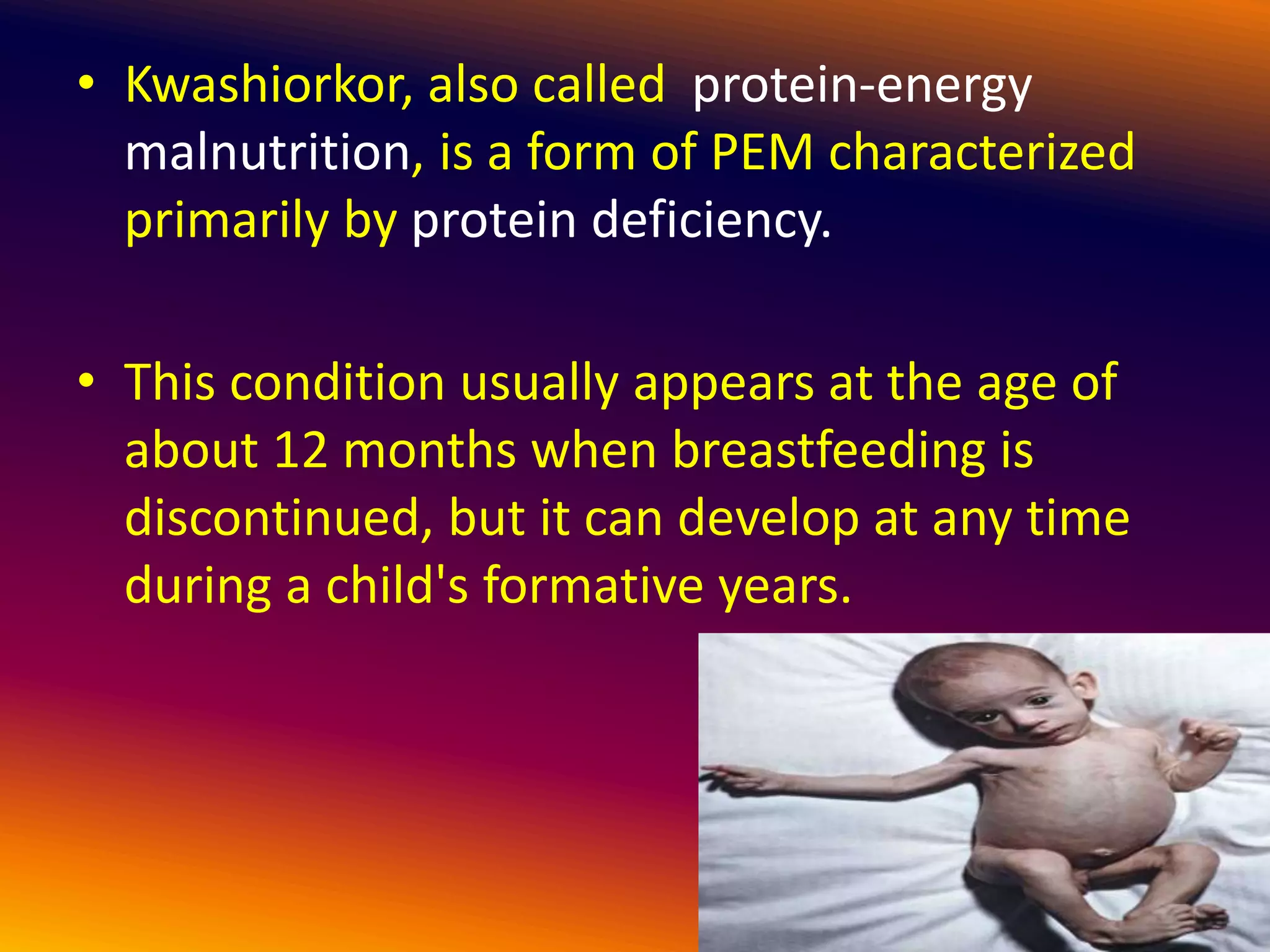 Malnutrition (Nutritional Health Problems) | PPTX