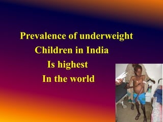 Prevalence of underweight
Children in India
Is highest
In the world
 