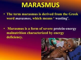 MARASMUS
• The term marasmus is derived from the Greek
word marasmos, which means ‘ wasting’.
• Marasmus is a form of severe protein-energy
malnutrition characterized by energy
deficiency.
 