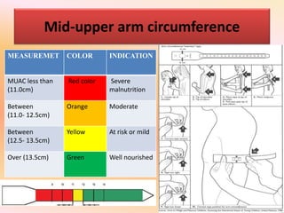 Mid-upper arm circumference
MEASUREMET COLOR INDICATION
MUAC less than
(11.0cm)
Red color Severe
malnutrition
Between
(11.0- 12.5cm)
Orange Moderate
Between
(12.5- 13.5cm)
Yellow At risk or mild
Over (13.5cm) Green Well nourished
 