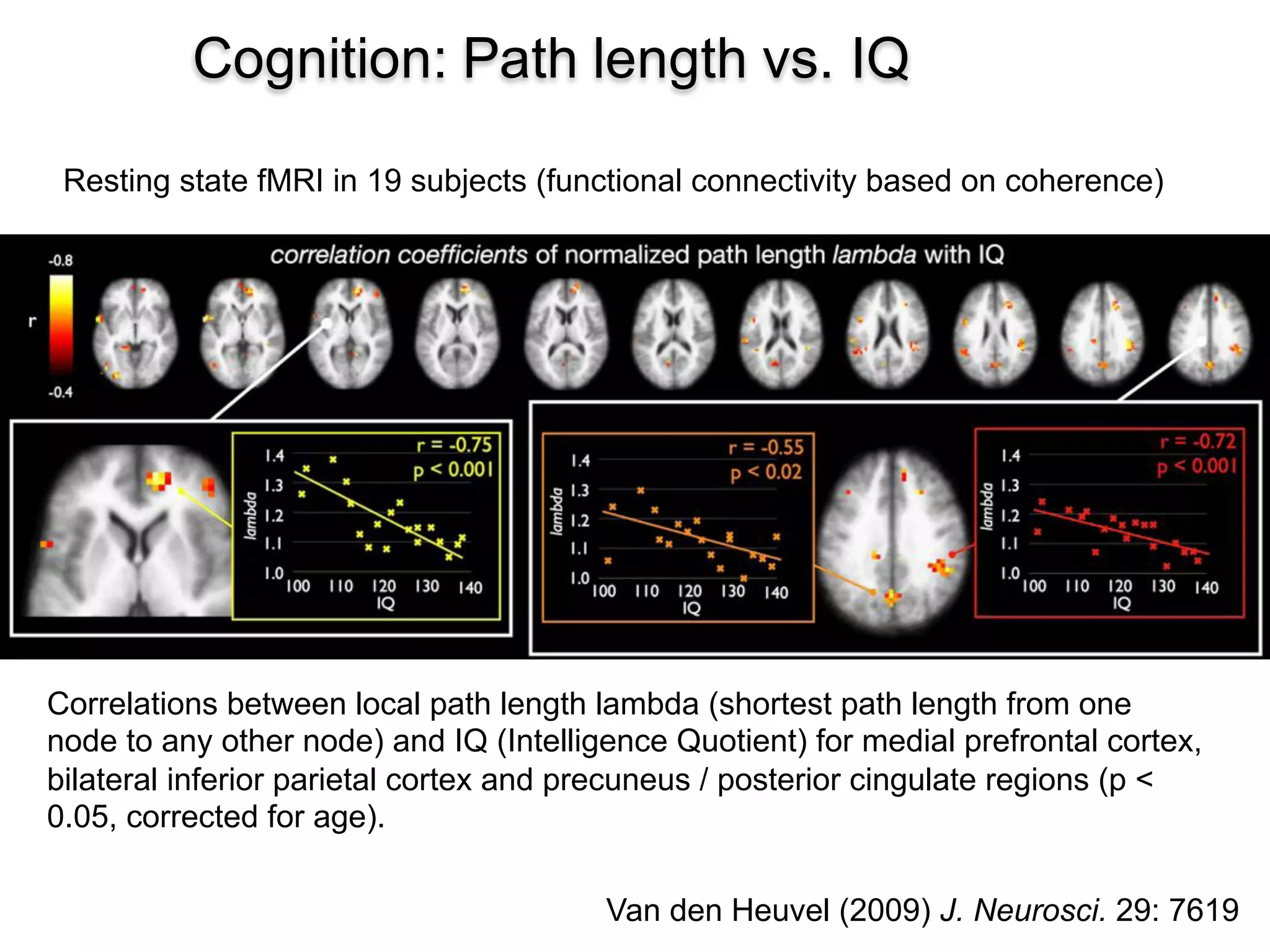 15
Cognition: Path length vs. IQ
Van den Heuvel (2009) J. Neurosci. 29: 7619
Correlations between local path length lambda (shortest path length from one
node to any other node) and IQ (Intelligence Quotient) for medial prefrontal cortex,
bilateral inferior parietal cortex and precuneus / posterior cingulate regions (p <
0.05, corrected for age).
Resting state fMRI in 19 subjects (functional connectivity based on coherence)
 