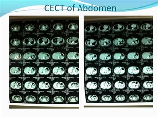 Case Presentation: Conservative Management of Penetrating Torso Injury ...