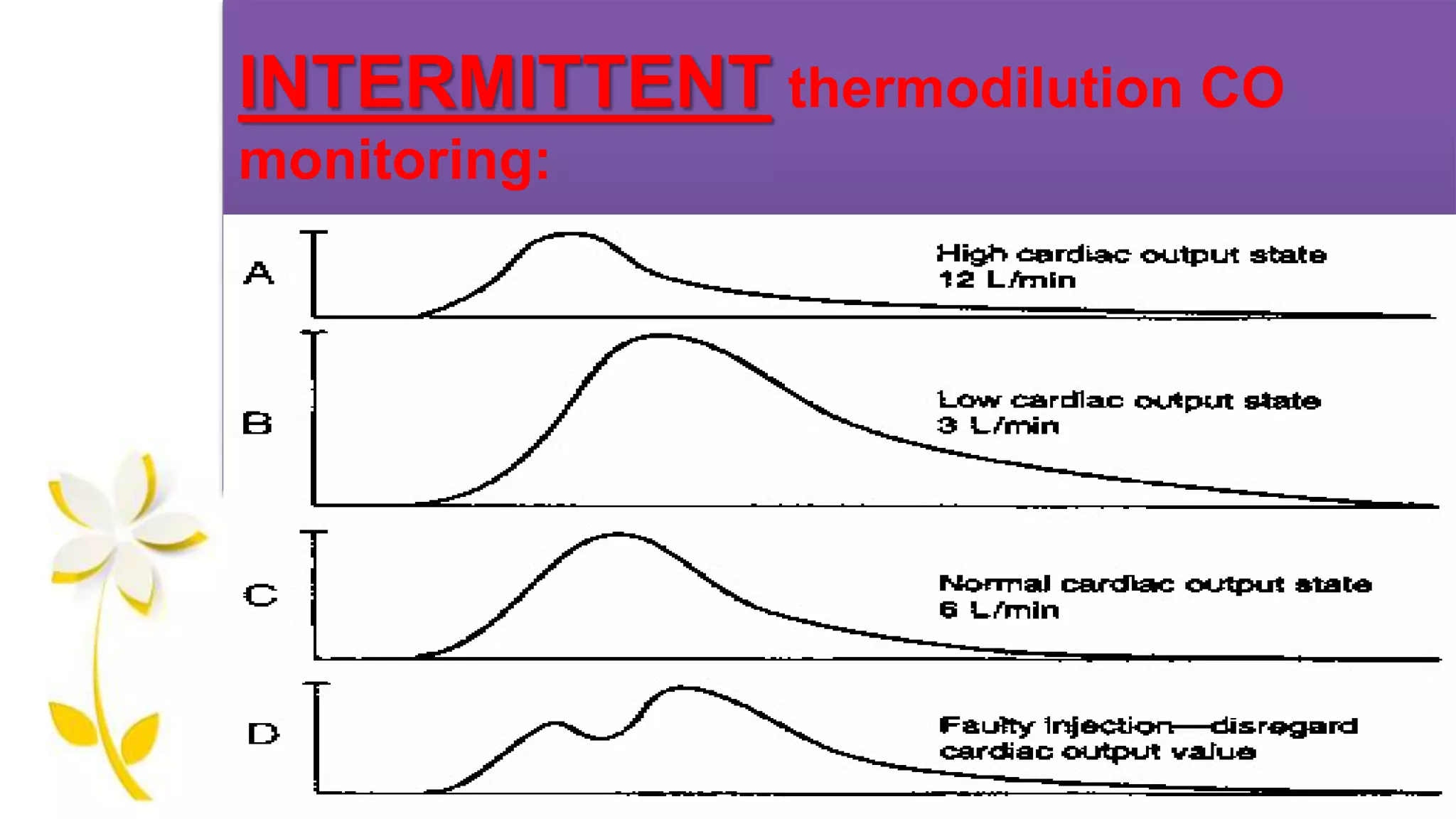 INTERMITTENT thermodilution CO
monitoring:
 
