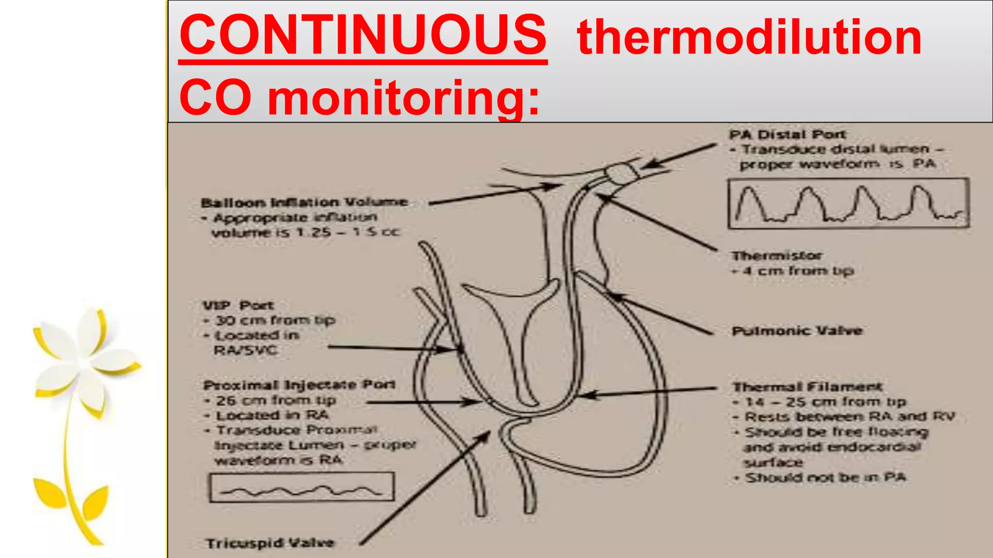 CONTINUOUS thermodilution
CO monitoring:
 