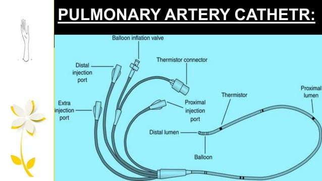 cardiac output monitoring | PPTX
