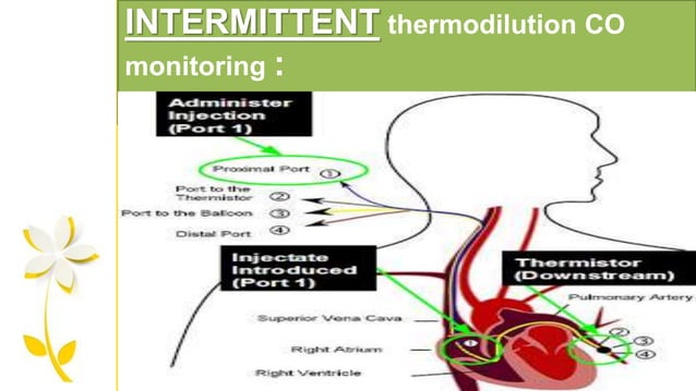 cardiac output monitoring | PPTX