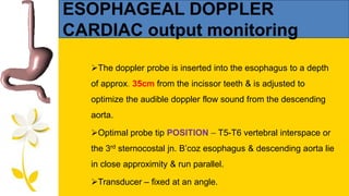 cardiac output monitoring | PPTX