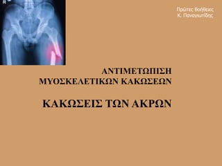 ΑΝΤΙΜΕΤΩΠΙΣΗ
ΜΥΟΣΚΕΛΕΤΙΚΩΝ ΚΑΚΩΣΕΩΝ
ΚΑΚΩΣΕΙΣ ΤΩΝ ΑΚΡΩΝ
Πρώτες Βοήθειες
Κ. Παναγιωτίδης
 