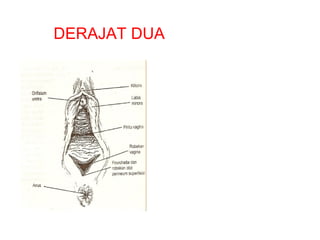 DERAJAT DUA
 