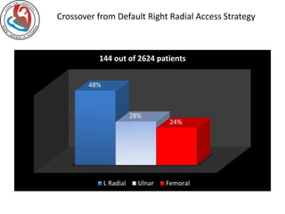 Crossover from Default Right Radial Access Strategy 
144 out of 2624 patients 
48% 
28% 
24% 
L Radial Ulnar Femoral 
 