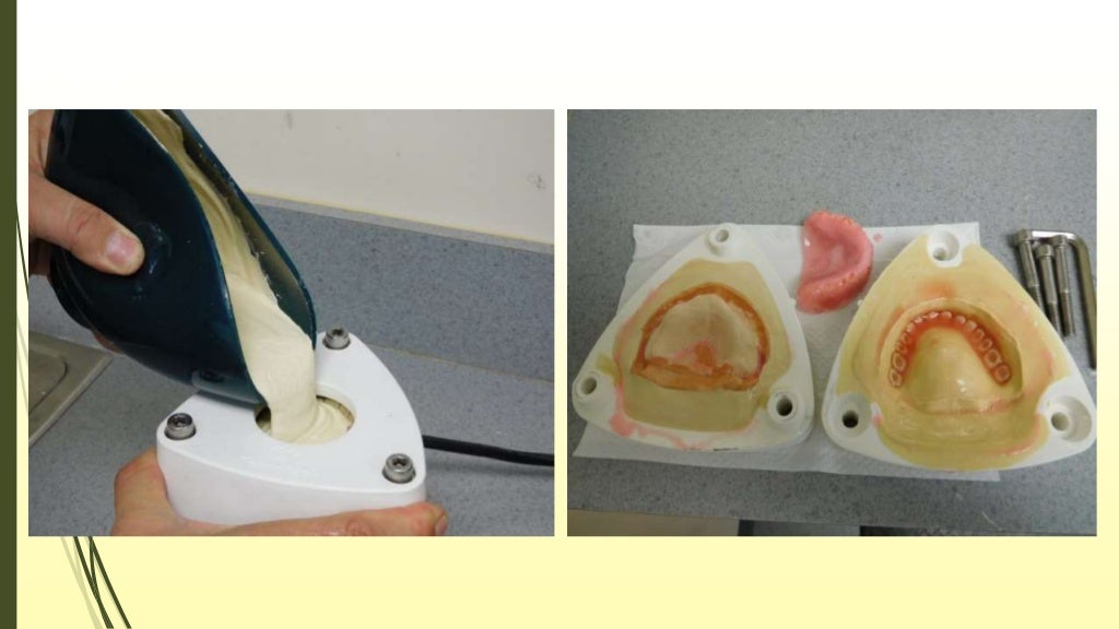 Denture base resin..