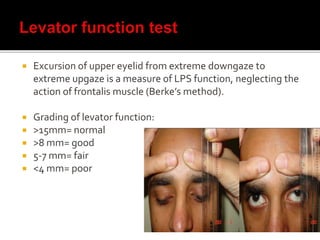 disorders of eyelids | PPTX