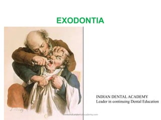 EXODONTIA
INDIAN DENTAL ACADEMY
Leader in continuing Dental Education
www.indiandentalacademy.com
 