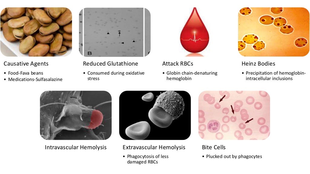 Types of anemia image