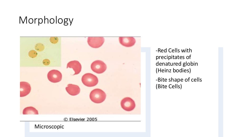 How to prevent anemia picture