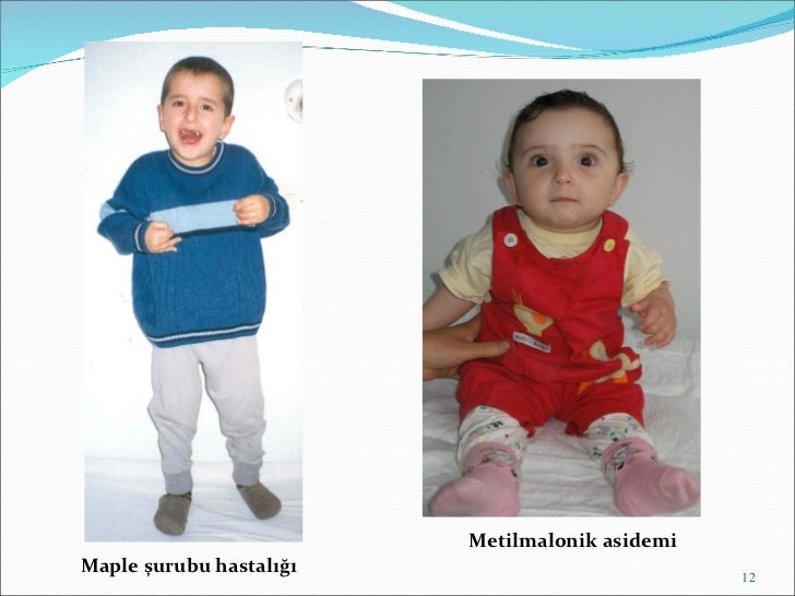 Kalıtsal metabolik hastalıklar (fazlası için www