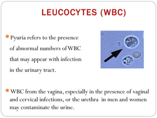 LEUCOCYTES (WBC)
Pyuria refers to the presence
of abnormal numbers ofWBC
that may appear with infection
in the urinary tract.
WBC from the vagina, especially in the presence of vaginal
and cervical infections, or the urethra in men and women
may contaminate the urine.
 