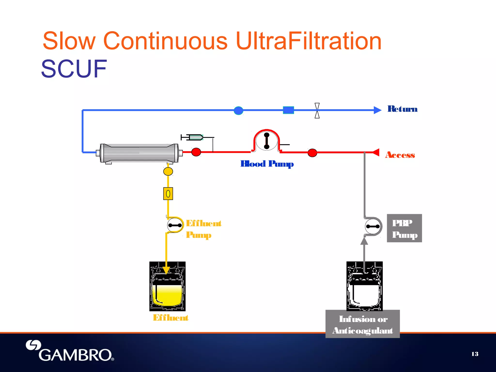 13
Slow Continuous UltraFiltration
Effluent
Pump
Infusion or
Anticoagulant
Blood Pump
PBP
Pump
Effluent
Access
Return
SCUF
 