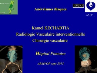 Kamel KECHABTIA
Radiologie Vasculaire interventionnelle
Chirurgie vasculaire
Hôpital Pontoise
ARMVOP sept 2013
Anévrismes iliaques
AP-HP
 
