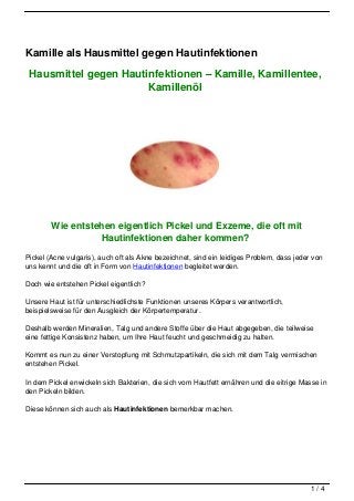 Kamille als Hausmittel gegen Hautinfektionen

 Hausmittel gegen Hautinfektionen – Kamille, Kamillentee,
                       Kamillenöl




        Wie entstehen eigentlich Pickel und Exzeme, die oft mit
                  Hautinfektionen daher kommen?
Pickel (Acne vulgaris), auch oft als Akne bezeichnet, sind ein leidiges Problem, dass jeder von
uns kennt und die oft in Form von Hautinfektionen begleitet werden.

Doch wie entstehen Pickel eigentlich?

Unsere Haut ist für unterschiedlichste Funktionen unseres Körpers verantwortlich,
beispielsweise für den Ausgleich der Körpertemperatur.

Deshalb werden Mineralien, Talg und andere Stoffe über die Haut abgegeben, die teilweise
eine fettige Konsistenz haben, um Ihre Haut feucht und geschmeidig zu halten.

Kommt es nun zu einer Verstopfung mit Schmutzpartikeln, die sich mit dem Talg vermischen
entstehen Pickel.

In dem Pickel enwickeln sich Bakterien, die sich vom Hautfett ernähren und die eitrige Masse in
den Pickeln bilden.

Diese können sich auch als Hautinfektionen bemerkbar machen.




                                                                                           1/4
 