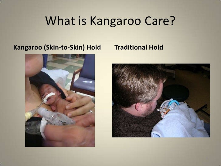 Kangaroo care