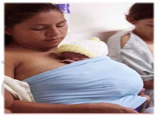 Kangaroo Mother Care
