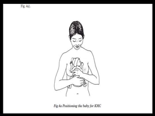 Kangaroo Mother Care