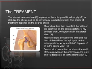 The EXAMINATION – Imaging StudiesDiagnosis is made using anteroposterior (AP) pelvis and lateral frog-leg radiographs. AP radiograph: The Klein line is drawn straight up the superior aspect of the femoral neck. This should intersect the epiphysis. If not, then it is likely an SCFE (see the image).Frog leg radiograph: A straight line through the center of the femoral neck proximally should be at the center of the epiphysis. If not, and the line is anterior in the epiphysis, it is likely an SCFE.Magnetic resonance imaging (MRI) depicts the slippage earliest, and MRI can demonstrate early marrow edema and slippage. MRI may be helpful in follow-up studies of the contralateral hip.The EXAMINATION – Lab. StudiesRoutine hormonal screening is not indicated. Endocrinopathies and medical disorders should be appropriately worked up in patients with an atypical presentation or other findings on history and physical examination that are consistent with endocrinologic disorders. A typical presentation is considered for children who present with SCFE who are younger than age 10 years or older than 16 years, as well as children who present with SCFE and short stature. It is also worth considering endocrinology laboratory work for a patient that is not obese but who falls within the 10 to 16 year age range.