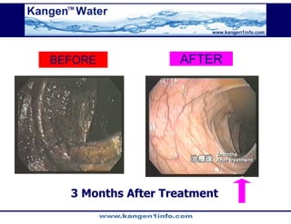 Kangen Synergy Worldwide Presentation (2)