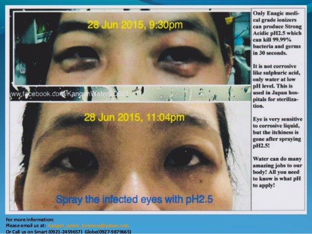 kangen water for eyes